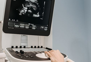Endometriosis USS